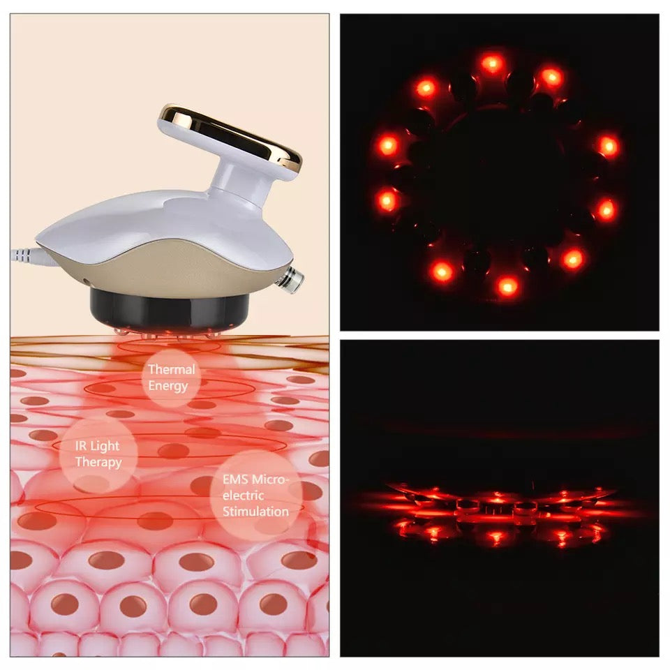 IR Trerapy, Thermal Energy, EMS Micro Electric Stimulation of Cupping Therapy Massager