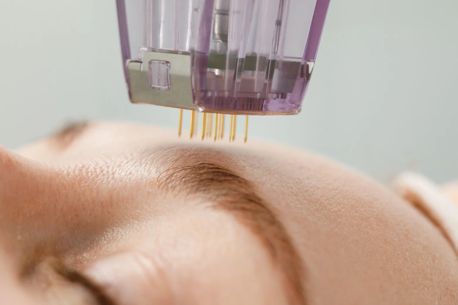 RF Microneedling Machines