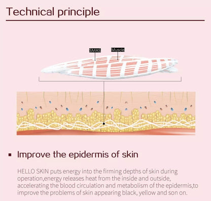 Technical principle
