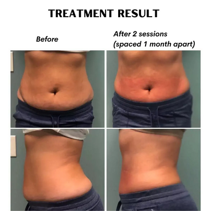 treatment coomparison