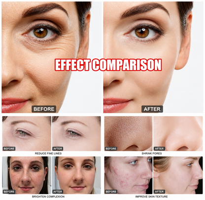 17 In 1 Hydra Skin Care System Facial Machine Elite