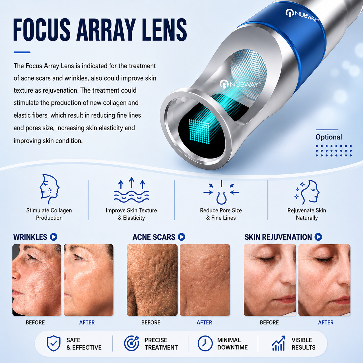 Laser Tattoo Removal Machine PicoLITE