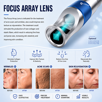 Laser Tattoo Removal Machine PicoLITE