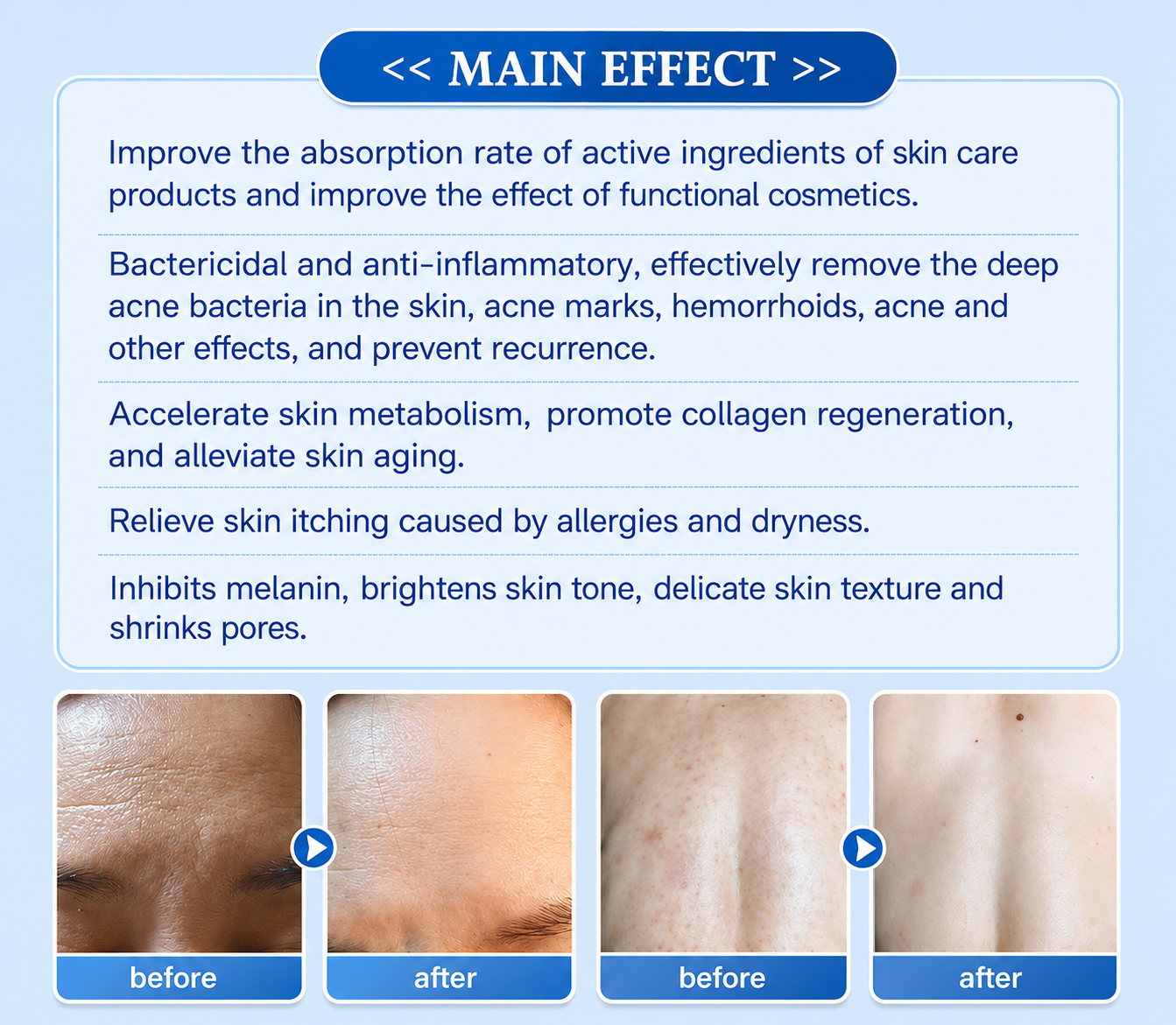 Plasma Pen Skin Care Machine
