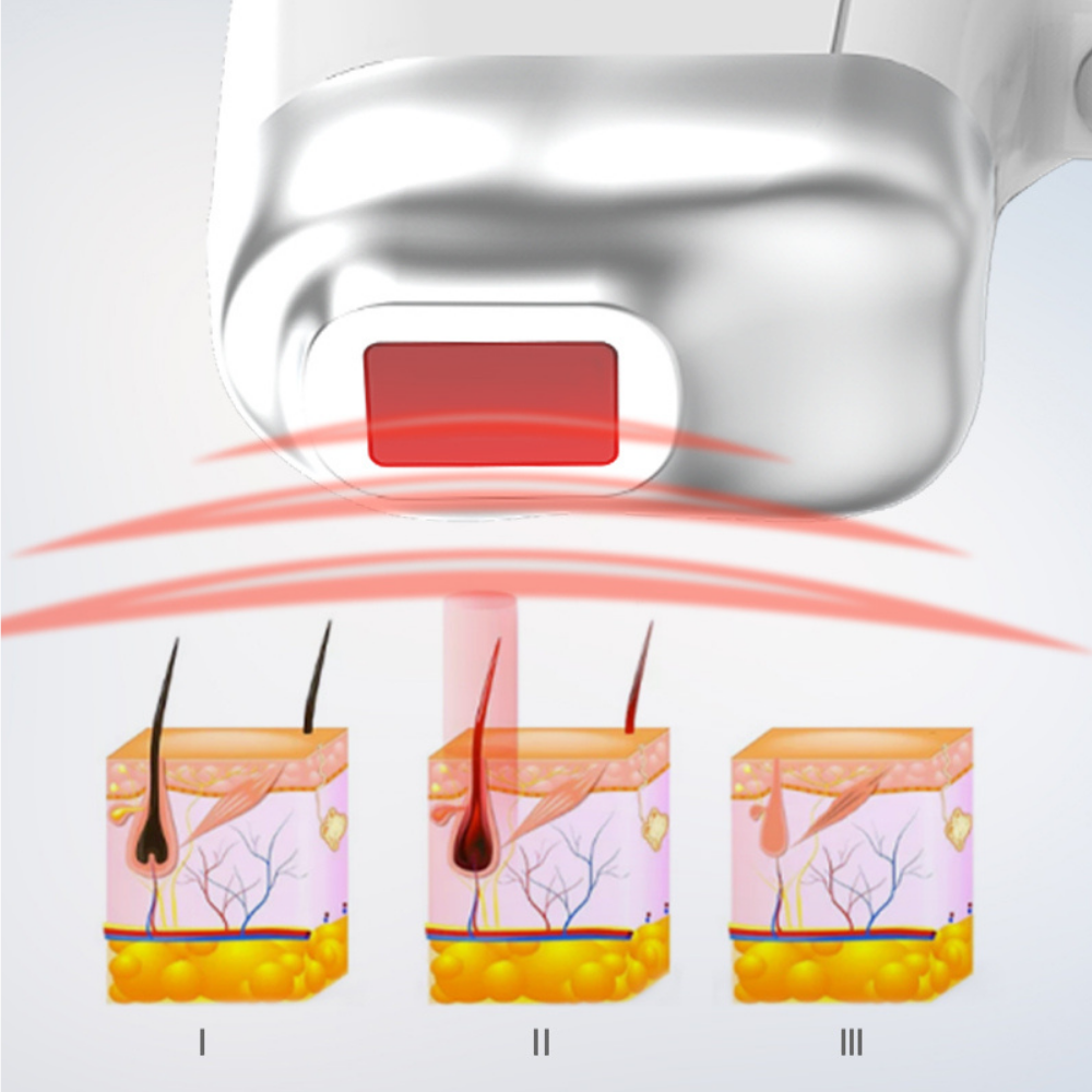Torno Elite Plus - Diode Laser Hair Removal Machine (4 Wavelengths)